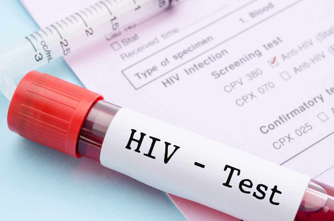 Kenya moves to ramp up HIV reduction drug