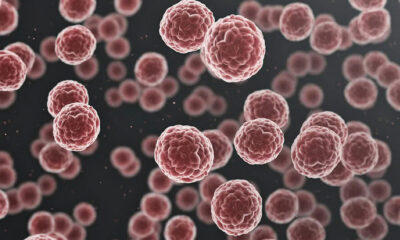 UWI medical researchers advocate for improved cancer care in developing states