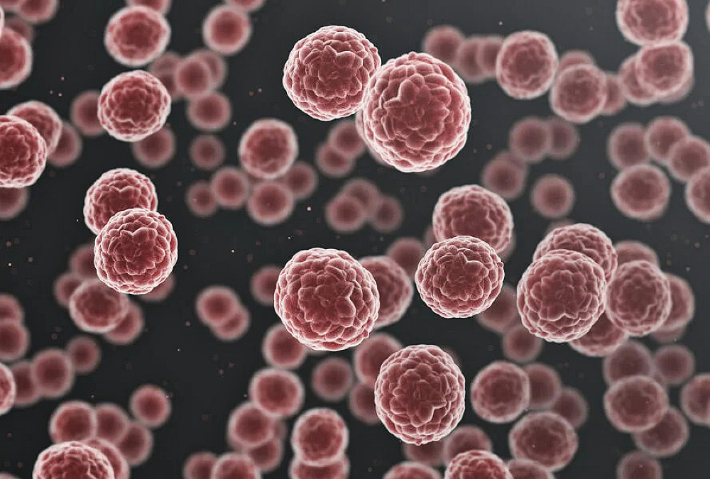 UWI medical researchers advocate for improved cancer care in developing states