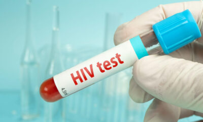 Caribbean Leads Global Decline in AIDS-Related Deaths, But Challenges Remain