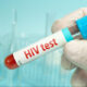 Caribbean Leads Global Decline in AIDS-Related Deaths, But Challenges Remain
